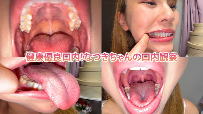h_1651nko0800002 健康優良口内！なつきちゃんの日内観察