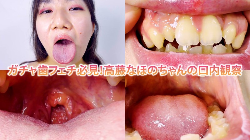 h_1651nko0800003 ガチャ歯フェチ必見！高藤なほのちゃんの口内観察