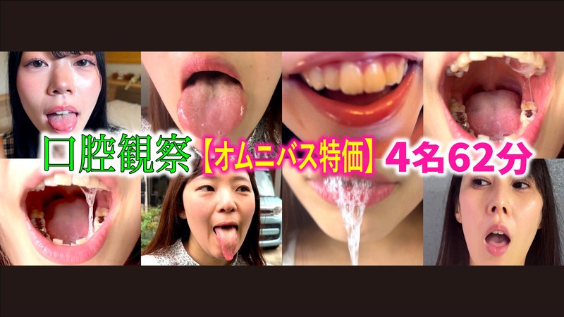 h_1651nko00004 【特価】口腔観察VOL.4 4名62分お買い得セット