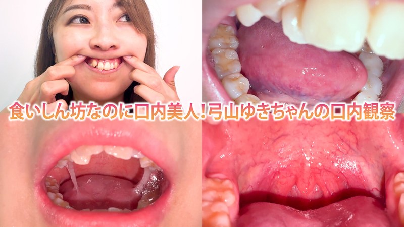 h_1651nko0800004 食いしん坊なのに口内美人！弓山ゆきちゃんの口内観察